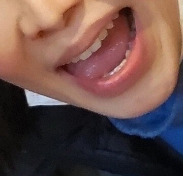 白衣