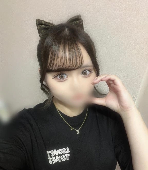 🫣