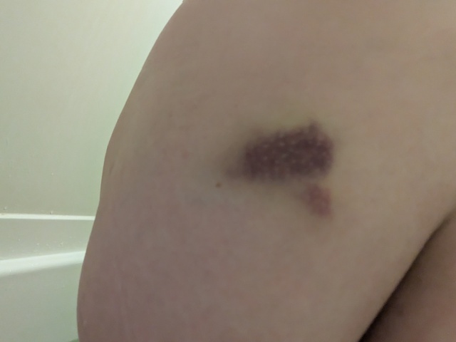 痛いと思ったら、、☺️