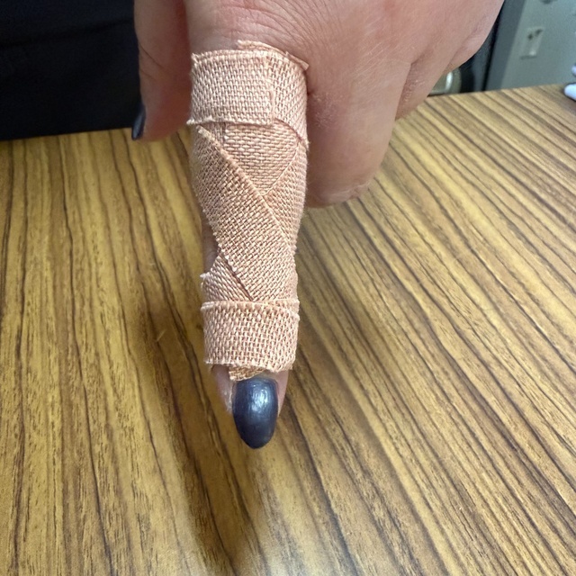 仕事で負傷？？？？｜写メ日記｜めい｜鶯谷 ぽっちゃりデリヘル 僕のぽっちゃり伝説