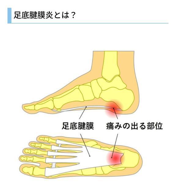 故障箇所が増えていく｜写メ日記｜岩崎｜鶯谷 人妻デリヘル 熟女デリヘル倶楽部