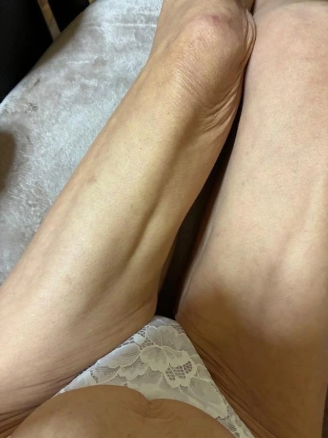 むしむし｜写メ日記｜よしこ｜立川・八王子・三多摩 人妻デリヘル 熟女の風俗最終章 立川店