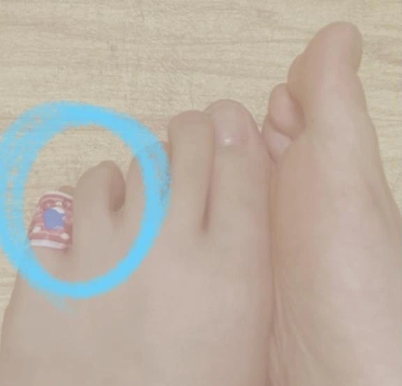 7/21お礼&サンダルとの闘いはまだまだ続く