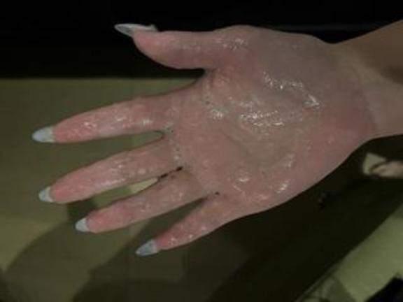 唾液
