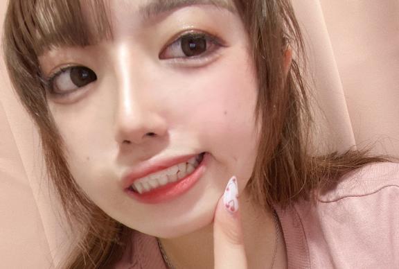 えくぼ紹介したげる｜写メ日記｜らんま｜新宿 一般デリヘル とある風俗店やりすぎさーくる新宿大久保店