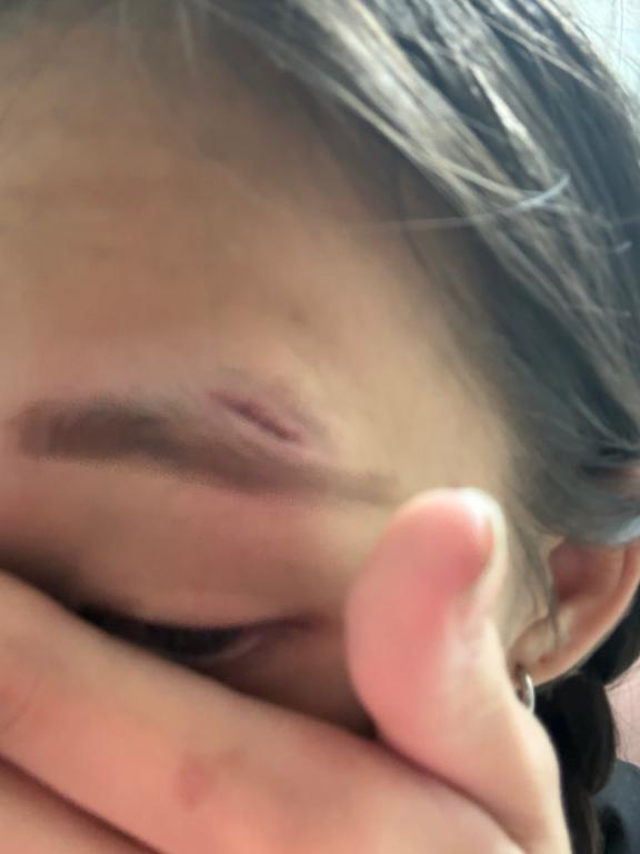 めばちこ｜写メ日記｜えりか｜新宿 一般デリヘル とある風俗店やりすぎさーくる新宿大久保店