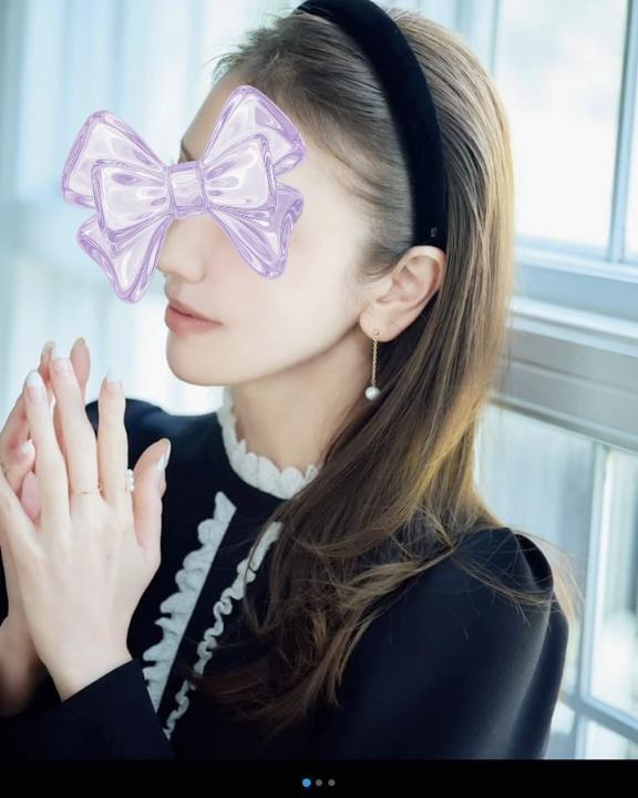 おでこ広いです