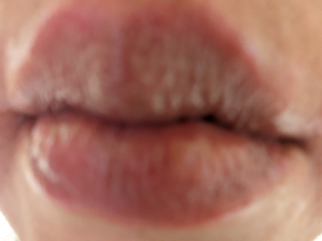 お早う御座います。