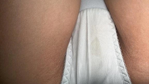 シミできちゃった