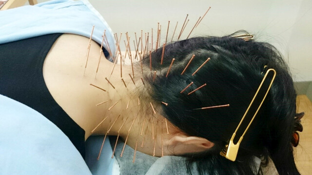 鍼治療。｜写メ日記｜ゆりえ｜鶯谷 人妻デリヘル 性腺熟女100%鶯谷（デリヘル市場）