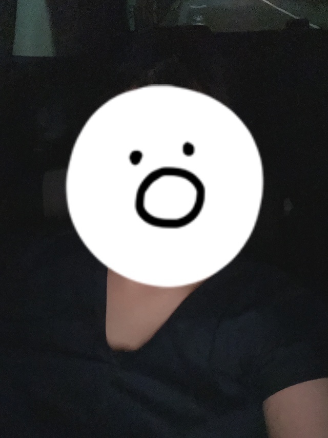 急遽