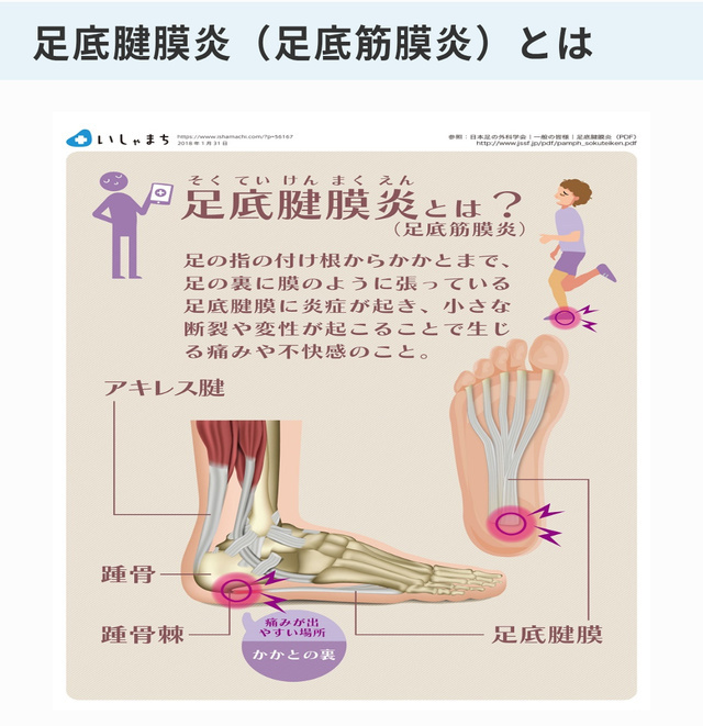 足底筋膜炎😣｜写メ日記｜岩崎｜鶯谷 人妻デリヘル おふくろ